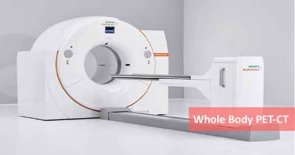 Whole body PET CT scan